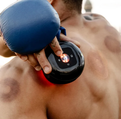 BodyLift Pro™ – Ventosas Eléctricas Inteligentes + Aceite de jengibre GRATIS